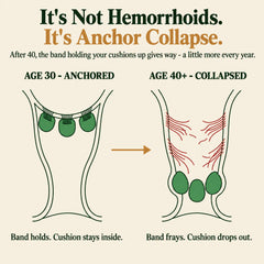 It's not hemorrhoids, it's anchor collapse — age 30 vs age 40+